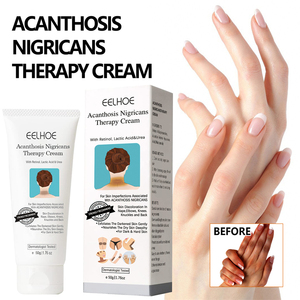 Crema Terapéutica para Acanthosis Nigricans de Marca Privada, 50g, para Espalda, Codos, Rodillas, Nudillos, Hidratante, Iluminadora y Exfoliante - Product Image 1