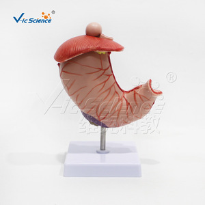 Modèle anatomique gastrique pathologique de grande taille ; outil pédagogique pour l'étude des structures pathologiques de l'estomac humain. - Product Image 1