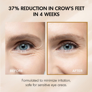 Crema Coreana de Marca Privada para el Contorno de Ojos, Reafirmante, Hidratante, con Retinol, Péptidos y Colágeno, Antiarrugas y Antihinchazón - Product Image 6