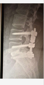 <span class=keywords><strong>Cage</strong></span> extensible en bois massif, <span class=keywords><strong>cage</strong></span> en bois massif, meilleure vente - Product Image 6