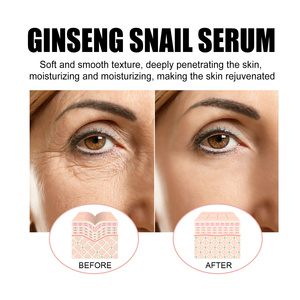 สารสกัดจากโสมหอยทากทำให้ผิวกระจ่างใสชุ่มชื้นและคงความชุ่มชื้น - Product Image 4