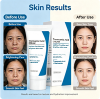 Crème hydratante pour le visage OEM Super White anti-âge, acide tranexamique, niacinamide, vitamine E, éclaircissante pour la peau, resserre les pores, crème végane