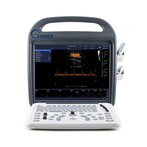 Escáner de Ultrasonido Doppler a Color Digital de Alta Resolución, Sistema de Imágenes Ultrasónicas para Embarazo, Veterinaria y Uso Humano CU23 - Product Image 4