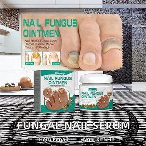 Vitamina E de absorción rápida para <span class=keywords><strong>la</strong></span> crema de tratamiento de <span class=keywords><strong>hongos</strong></span> con desintoxicación para <span class=keywords><strong>La</strong></span> onicomicosis del dedo del pie para el cuidado de <span class=keywords><strong>hongos</strong></span> Suministro directo de fábrica - Product Image 3