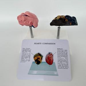 Modelo de Patología del Corazón Humano para Ciencias Médicas, Modelo de Enfermedades Orgánicas, Modelo Antidrogas - Product Image 6