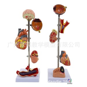 Modelo de hipertensión/presión arterial; Modelo de diabetes/visceras patológicas; Cerebro patológico; Presión ocular; Corazón; Riñones; - Product Image 4