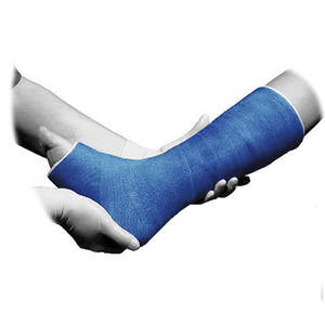 رخيصة الثمن Ansen الصب ---- الطبية العظام الاصطناعية الفيبرجلاس راتينج البوليستر شريط صب ضمادة - Product Image 6