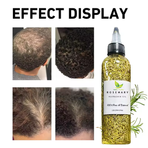 カスタムハーブオーガニックハーブ天然ビオチン栄養再生オイル急速ローズマリーオイル育毛製品プライベートラベル - Product Image 5