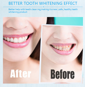 Balinda TWK-401 Jeringa de Doble Cuerpo para Blanqueamiento Dental con Gel de Peróxido de Hidrógeno al 44% y 35%, 16 Minutos de Uso, Certificación CE ROHS, 1 Año de Garantía - Product Image 6