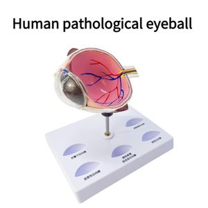 Fabricant ventes directes modèle d'oeil anatomique cataracte PVC matériel pour <span class=keywords><strong>ophtalmologie</strong></span> <span class=keywords><strong>collège</strong></span> médecin outils sciences médicales - Product Image 4