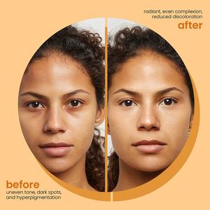 Savon Solide à l'Acide Kojique et à la Vitamine C Prof.ding, Ingrédients Minéraux, Effet Éclaircissant et Nettoyant - Product Image 3