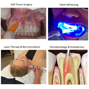 Máquina Láser <span class=keywords><strong>Dental</strong></span> de Diodo Eléctrico Portátil de 450nm 650nm 980nm para Cirugía de Tejidos Blandos, Dispositivo <span class=keywords><strong>Dental</strong></span> - Product Image 5