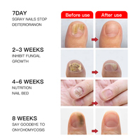 Patchs de soin doux pour les ongles abîmés avec coussinets hydrocolloïdes souples