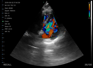 ポータブルワイヤレス超音波マシン/スキャナーKontedC10T - Product Image 3
