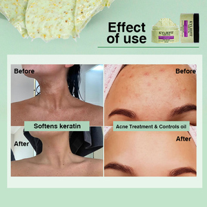 <span class=keywords><strong>Gommage</strong></span> Corpo Ecologico Private Label con Aloe Vera, Avocado e Vitamina C - Esfoliante Idratante Profondo, Antiacne e Sbiancante - Product Image 5