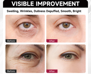Patchs de gel pour les yeux véganes personnalisés avec logo, masque hydrogel au collagène et acide hyaluronique sur feuille de coton pour spa et salon, OEM/ODM, marque privée - Product Image 2