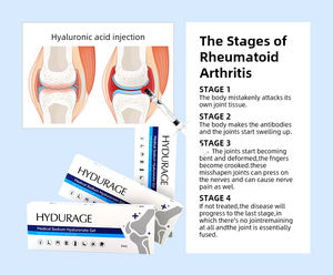 Remplisseur articulaire HADURAGE en direct d'usine, 2 ml, 3 ml, arthrose du genou, marque personnalisée - Product Image 2