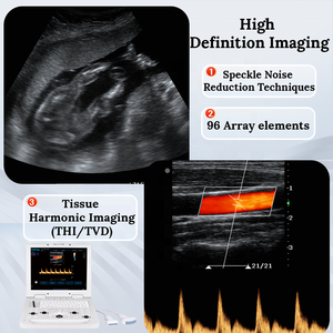 Harga pabrik ecocardiografi warna hewan Doppler Scan PW Laptop portabel mesin <span class=keywords><strong>Ultrasound</strong></span> 3D untuk rumah sakit - Product Image 2