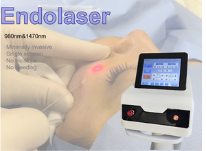 Liposuccion endolaser, lifting du visage, laser diode 980 nm 1470 nm, <span class=keywords><strong>lipolyse</strong></span>, élimination de la graisse, <span class=keywords><strong>injection</strong></span>, réduction du <span class=keywords><strong>double</strong></span> <span class=keywords><strong>menton</strong></span>, appareil Lipopapada - Product Image 6