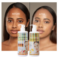La meilleure crème pour le visage à la vitamine C biologique O'carly, lotion corporelle super blanchissante pour les mains, pour les peaux noires.