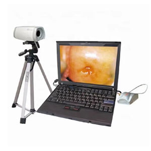 Colposcope numérique pour gynécologie, caméra électronique de colposcopie vidéo pour <span class=keywords><strong>vagin</strong></span> - Product Image 2
