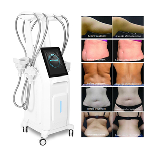 Approuvé CE FDA 360 °   <span class=keywords><strong>Appareil</strong></span> de <span class=keywords><strong>cryolipolyse</strong></span> à 4 poignées pour la congélation des graisses, le remodelage corporel et l'élimination de la cellulite pour salons et cliniques - Product Image 4