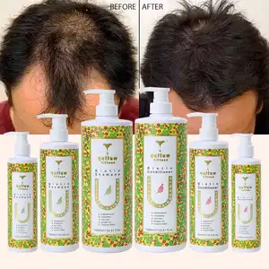 Fabricant de gros Shampooing à la menthe poivrée et au romarin pour la pousse des cheveux Shampooing bio au gingembre et aux cheveux noirs à la biotine pour la pousse des cheveux - Product Image 1