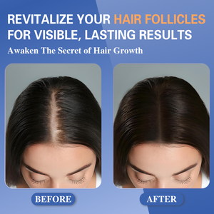 <span class=keywords><strong>มู</strong></span><span class=keywords><strong>ส</strong></span>ปลูก<span class=keywords><strong>ผม</strong></span> GZ OEM - บำรุงผมหนา แข็งแรง และฟื้นฟูราก<span class=keywords><strong>ผม</strong></span> รองรับการผลิตแบบ Private LOGO - Product Image 2