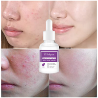 Sérum anti-acné Wishgan BHA 2% : solution avancée qui élimine les boutons et atténue les marques d'acné tout en apaisant et réparant la peau