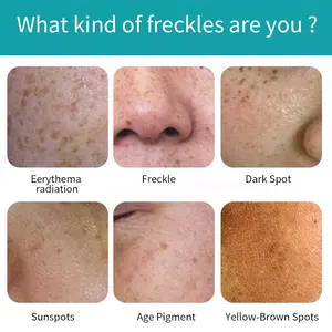 Oem Pimples Melasma Blemish Brighten Dark Spot Corrector Remover Cream Strong Bleaching Whitening Face Freckle Remove Cream