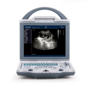Kaixin KX5600V - Dispositivo de Monitoreo Veterinario Portátil de Alto Rendimiento, Escáner de Ultrasonido Médico Tipo Laptop - Product Image 1