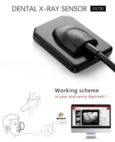 Système de capteur numérique intra-oral RVG dentaire Runyes DR730 avec capteur d'imagerie CMOS APS et pilote TWAIN compatible avec Win7/8/10