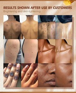 Crema Corporal Vegana de 200 ml de Marca Privada OEM, Hidratación Duradera, Manteca de Karité, Niacinamida, Elimina las Imperfecciones, Unifica el Tono de <span class=keywords><strong>la</strong></span> Piel - Product Image 2
