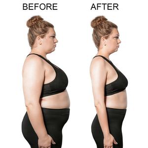 OEM/ODM Certificado Halal Belleza Natural Adelgazante Desintoxicante de Ciruela Efectivo Bajo en Carbohidratos para Pérdida de Peso Belleza Salud Digestiva para Adultos - Product Image 5