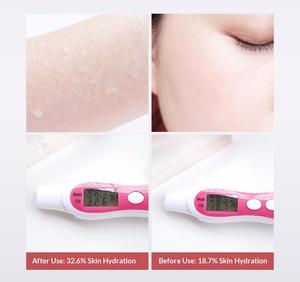 جهاز تجميل محمول متقدم لترطيب الوجه بتقنية PVD وضباب النانو وعلاج الأكسجين عالي الضغط - Product Image 4