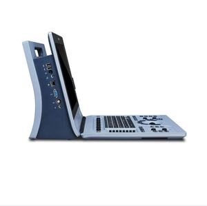 Mesin Diagnosis <span class=keywords><strong>Ultrasound</strong></span> Portabel Mesin Sonografi Edan <span class=keywords><strong>Ultrasound</strong></span> - Product Image 5
