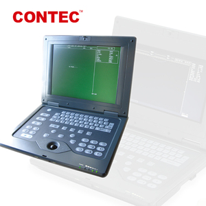 Équipement diagnostique vétérinaire courant limité de scanner animal portatif CMS600P-VET d'ultrason - Product Image 4