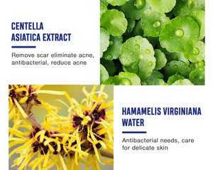 Crema QBEKA para el Tratamiento del Acné, Reafirmante, Elimina Cicatrices de Acné, Antienvejecimiento, Reduce el Enrojecimiento Facial, Mejora la Reducción de Poros, Crema Facial - Product Image 4