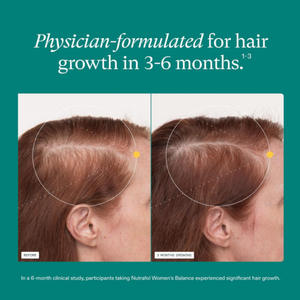 補助食品強化ビオチンカプセル,女性用バランス成長サプリメント - Product Image 2