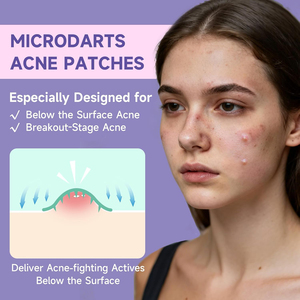 Parches Hidrocoloides Multiforma para Granos y Acné, 27 Unidades, con Ácido Salicílico y Madecossoside, Parches Micro-dart para Imperfecciones Profundas - Product Image 2