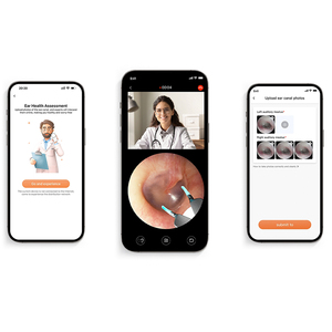 Removedor <span class=keywords><strong>de</strong></span> <span class=keywords><strong>Cera</strong></span> <span class=keywords><strong>de</strong></span> Oídos Inteligente Todo en Uno H30S con Telemedicina con IA y Administración <span class=keywords><strong>de</strong></span> Líquidos, Limpiador Visual <span class=keywords><strong>de</strong></span> Oídos y Analizador <span class=keywords><strong>de</strong></span> Salud - Product Image 3