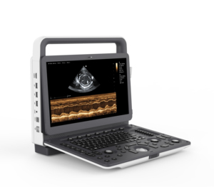 Zoncare M70, meilleur appareil d'échographie Doppler couleur portable pour les opérations de santé animale sur site - Product Image 1