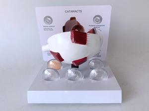 Recursos Didácticos Experimentales de Ciencias Médicas: Globo Ocular Humano, <span class=keywords><strong>Cataratas</strong></span>, Enfermedades Oculares, Pupila - Product Image 2