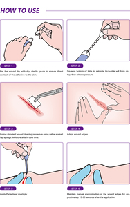 Pegamento adhesivo quirúrgico para <span class=keywords><strong>heridas</strong></span>, adhesivo para curar <span class=keywords><strong>heridas</strong></span>, certificado CE - Product Image 4