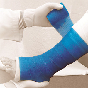 Bande de résine orthopédique en fibre de verre ou polyester, <span class=keywords><strong>attelle</strong></span> synthétique haute résistance certifiée CE MDR. - Product Image 6
