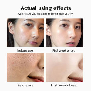 28 bottiglie di 5% ampolla di Nicotinamide siero vitamina <span class=keywords><strong>C</strong></span> B3 sbiancante idratante Anti Anti-invecchiamento per la pelle secca viso mirato - Product Image 6