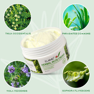 <span class=keywords><strong>Crema</strong></span> para el Acné con Aceite de Árbol de Té OEM, Fórmula Vegana Orgánica con Glicerina para Todo Tipo de Piel - Hidratante y Elimina Cicatrices - Product Image 2