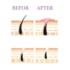 PANSLY Spray Suppresseur de Poils pour le Visage – Sérum Épilatoire Essentiel pour Soins de la Peau - Product Image 5