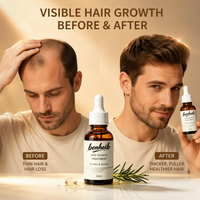 Serum Perawatan Pertumbuhan Rambut Alami Organik Harga Grosir Minyak Rosemary untuk Pertumbuhan Rambut Manfaat Anti-Ketombe