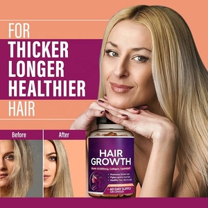 Suplementos OEM para la piel, el cabello y las uñas, reduce la pérdida de cabello, cápsulas para el crecimiento del cabello - Product Image 2